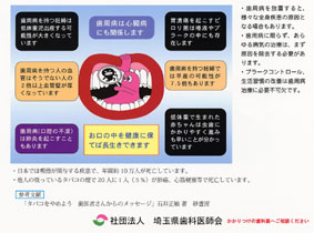 歯周病を放置すると、様々な全身疾患の原因となる場合もあります。